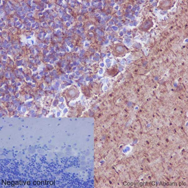 Immunohistochemistry (Formalin/PFA-fixed paraffin-embedded sections) - Anti-alpha Tubulin (acetyl K40) antibody [EPR16772] (AB179484), expandable thumbnail