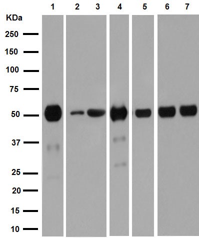 Western blot - Anti-alpha Tubulin (acetyl K40) antibody [EPR16772] (AB179484), expandable thumbnail