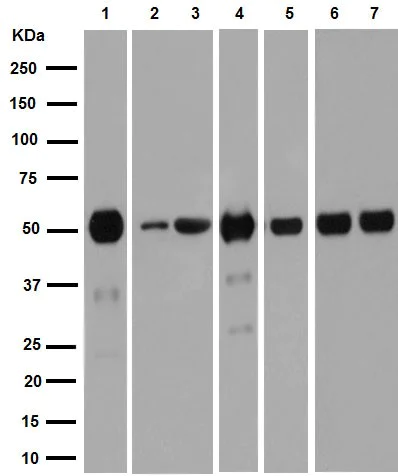 Anti-alpha Tubulin (acetyl K40) antibody [EPR16772] (ab179484) | Abcam