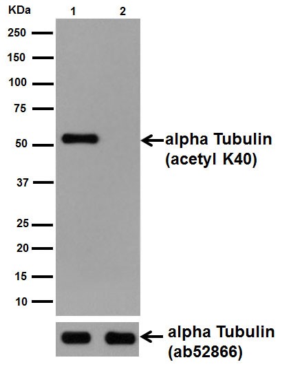 Western blot - Anti-alpha Tubulin (acetyl K40) antibody [EPR16772] (ab179484), expandable thumbnail