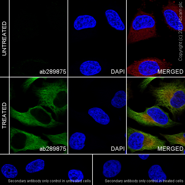 Immunocytochemistry/ Immunofluorescence - Anti-alpha Tubulin (acetyl K40) antibody [EPR16772] - Goat IgG (Chimeric) (AB289875)
