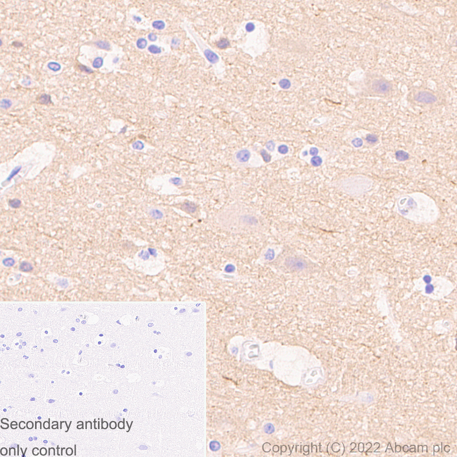 Immunohistochemistry (Formalin/PFA-fixed paraffin-embedded sections) - Anti-alpha Tubulin (acetyl K40) antibody [EPR16772] - Goat IgG (Chimeric) (AB289875)
