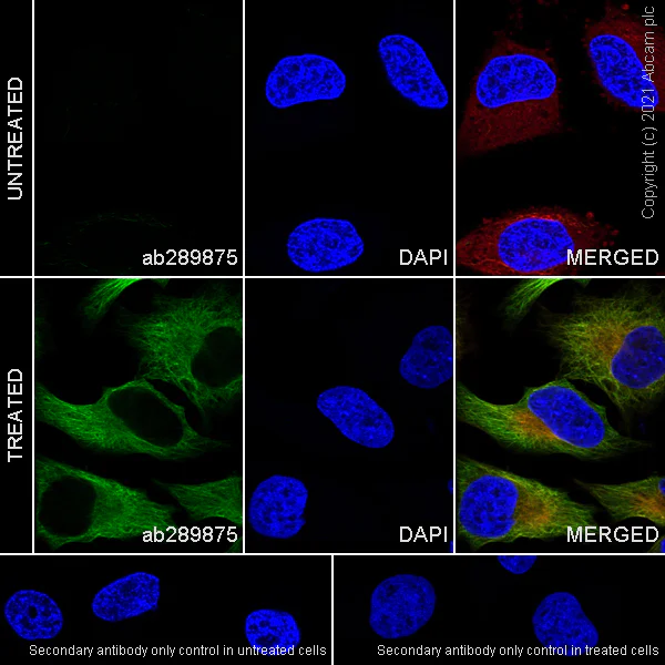 Immunocytochemistry/ Immunofluorescence - Anti-alpha Tubulin (acetyl K40) antibody [EPR16772] - Goat IgG (Chimeric) - BSA and Azide free (AB289877)
