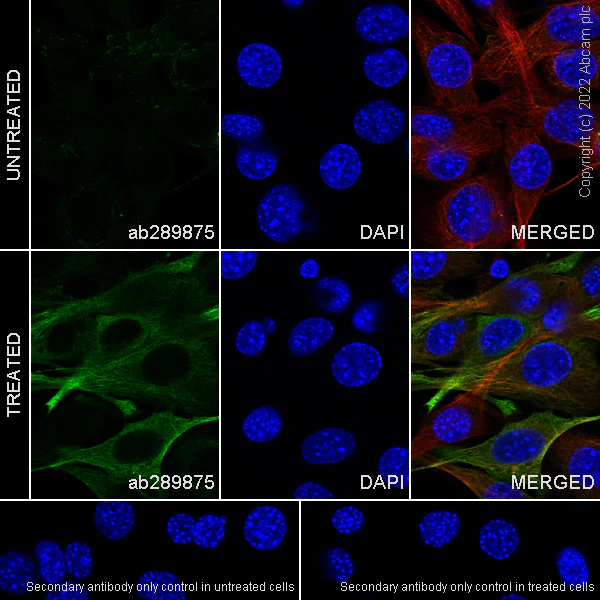 Immunocytochemistry/ Immunofluorescence - Anti-alpha Tubulin (acetyl K40) antibody [EPR16772] - Goat IgG (Chimeric) - BSA and Azide free (AB289877)