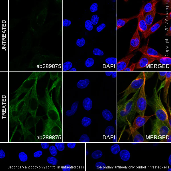 Immunocytochemistry/ Immunofluorescence - Anti-alpha Tubulin (acetyl K40) antibody [EPR16772] - Goat IgG (Chimeric) - BSA and Azide free (AB289877)