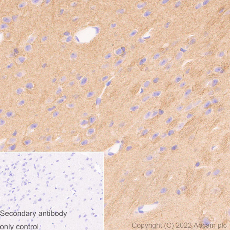 Immunohistochemistry (Formalin/PFA-fixed paraffin-embedded sections) - Anti-alpha Tubulin (acetyl K40) antibody [EPR16772] - Goat IgG (Chimeric) - BSA and Azide free (AB289877)