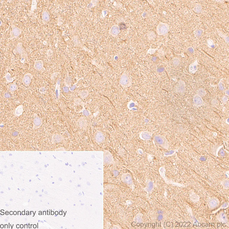 Immunohistochemistry (Formalin/PFA-fixed paraffin-embedded sections) - Anti-alpha Tubulin (acetyl K40) antibody [EPR16772] - Goat IgG (Chimeric) - BSA and Azide free (AB289877)
