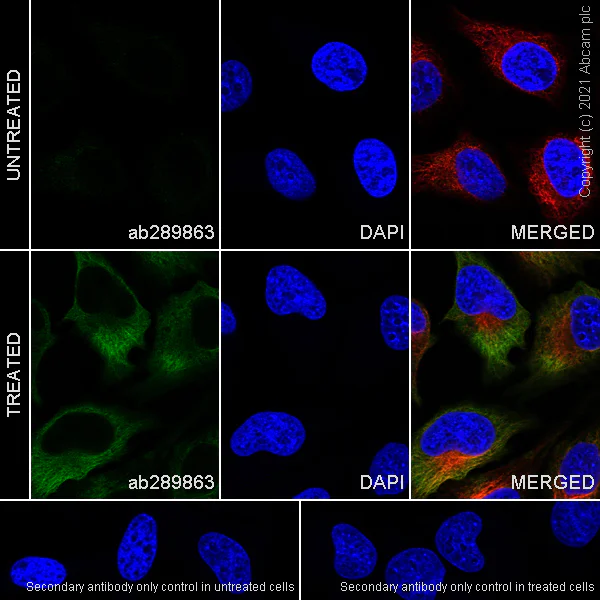Immunocytochemistry/ Immunofluorescence - Anti-alpha Tubulin acetyl K40 antibody [EPR16772] - Rat IgG2a (Chimeric) (AB289863)