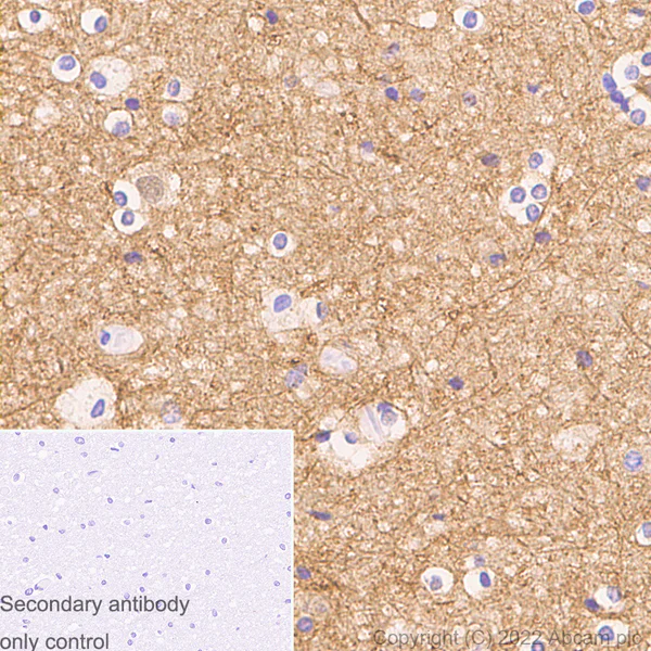 Immunohistochemistry (Formalin/PFA-fixed paraffin-embedded sections) - Anti-alpha Tubulin acetyl K40 antibody [EPR16772] - Rat IgG2a (Chimeric) (AB289863)