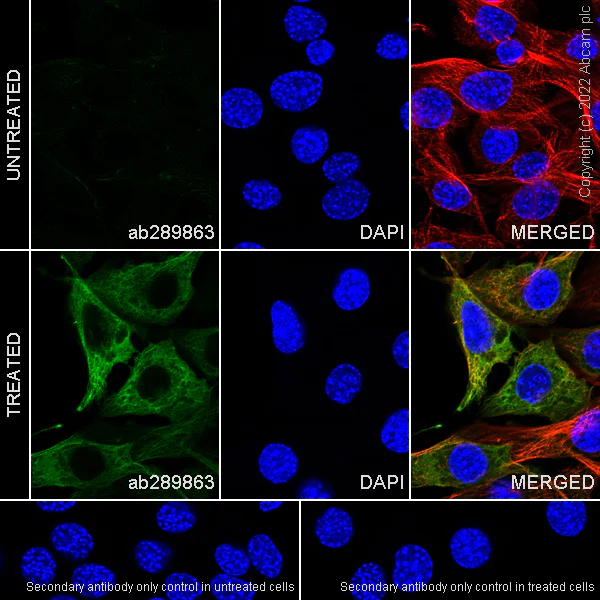 Immunocytochemistry/ Immunofluorescence - Anti-alpha Tubulin acetyl K40 antibody [EPR16772] - Rat IgG2a (Chimeric) - BSA and Azide free (AB289872)