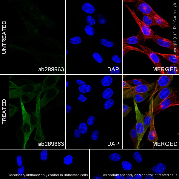 Immunocytochemistry/ Immunofluorescence - Anti-alpha Tubulin acetyl K40 antibody [EPR16772] - Rat IgG2a (Chimeric) - BSA and Azide free (AB289872)