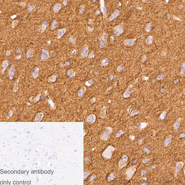 Immunohistochemistry (Formalin/PFA-fixed paraffin-embedded sections) - Anti-alpha Tubulin acetyl K40 antibody [EPR16772] - Rat IgG2a (Chimeric) - BSA and Azide free (AB289872)