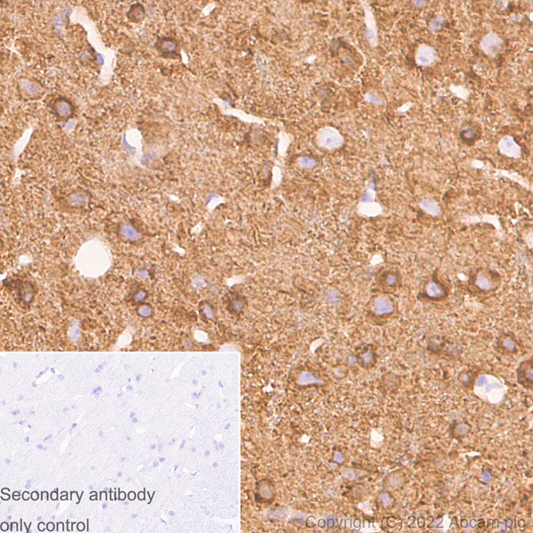 Immunohistochemistry (Formalin/PFA-fixed paraffin-embedded sections) - Anti-alpha Tubulin acetyl K40 antibody [EPR16772] - Rat IgG2a (Chimeric) - BSA and Azide free (AB289872)