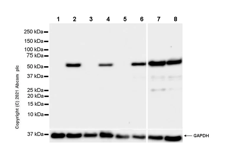Western blot - Anti-alpha Tubulin acetyl K40 antibody [EPR16772] - Rat IgG2a (Chimeric) - BSA and Azide free (AB289872)