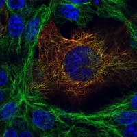 Immunocytochemistry - Anti-alpha Tubulin antibody [B-5-1-2] (AB11304), expandable thumbnail