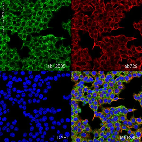 Immunocytochemistry/ Immunofluorescence - Anti-alpha Tubulin antibody [DM1A] - Loading Control (AB7291)