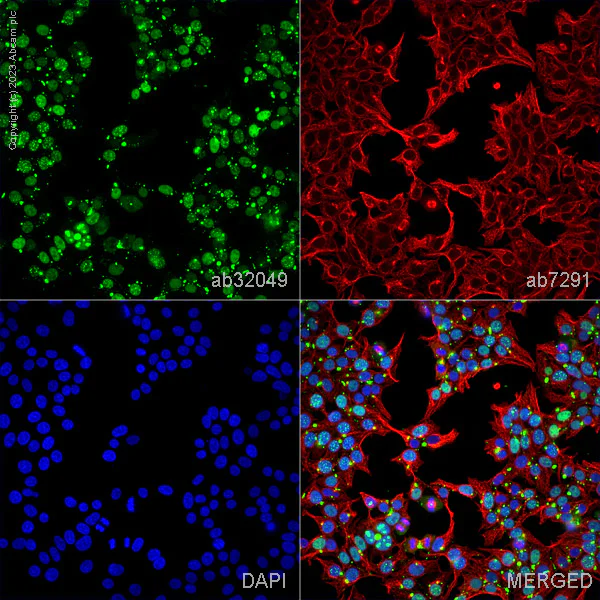 Immunocytochemistry/ Immunofluorescence - Anti-alpha Tubulin antibody [DM1A] - Loading Control (AB7291)