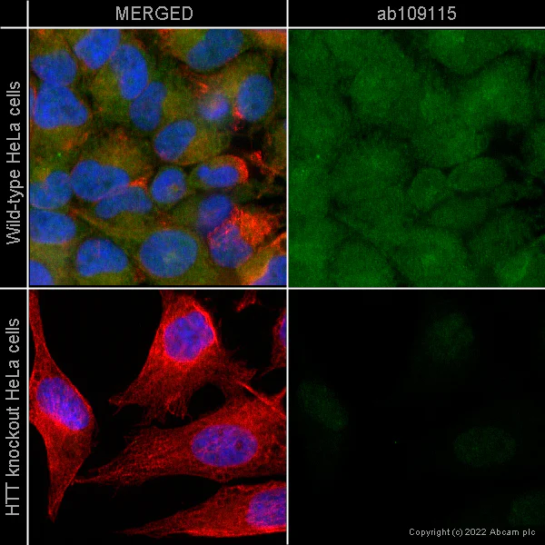 Immunocytochemistry/ Immunofluorescence - Anti-alpha Tubulin antibody [DM1A] - Loading Control (AB7291)