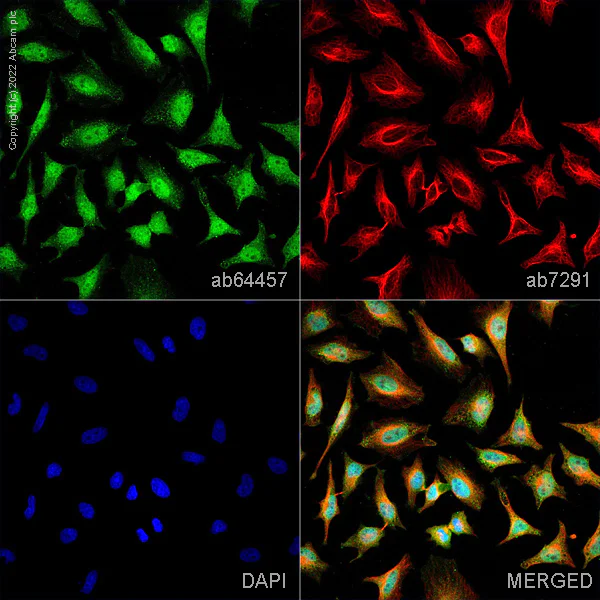 Immunocytochemistry/ Immunofluorescence - Anti-alpha Tubulin antibody [DM1A] - Loading Control (AB7291)