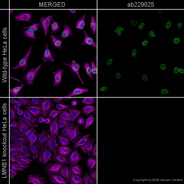 Immunocytochemistry/ Immunofluorescence - Anti-alpha Tubulin antibody [DM1A] - Loading Control (AB7291)