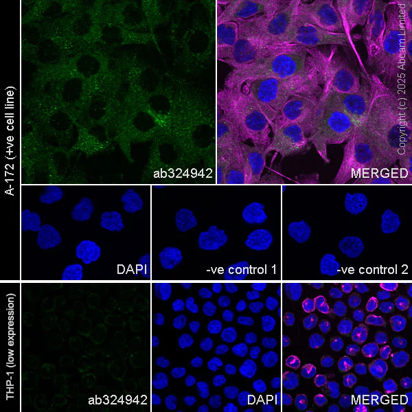 Immunocytochemistry/ Immunofluorescence - Anti-alpha Tubulin antibody [DM1A] - Loading Control (AB7291)