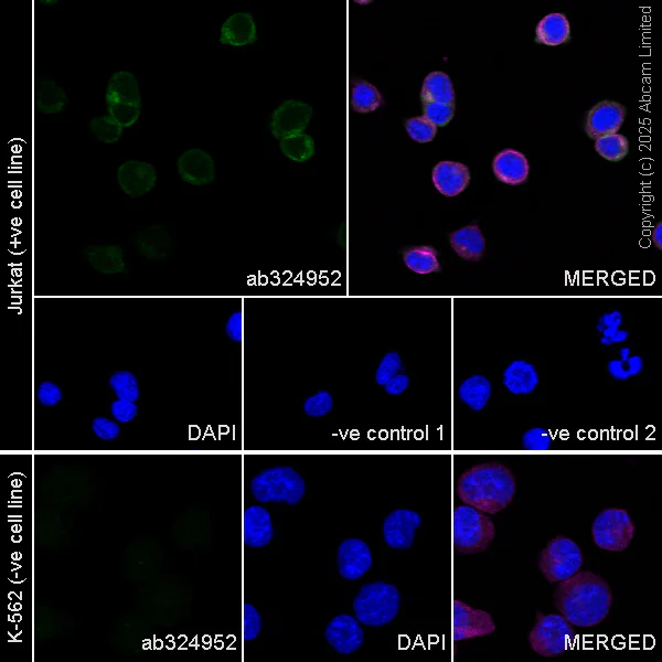 Immunocytochemistry/ Immunofluorescence - Anti-alpha Tubulin antibody [DM1A] - Loading Control (AB7291)