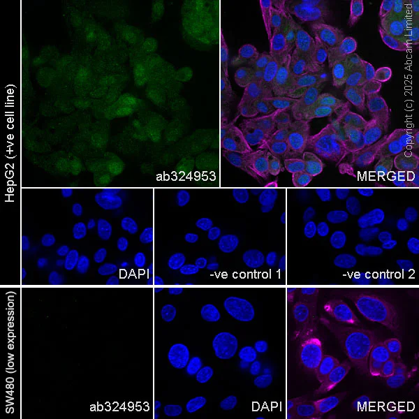 Immunocytochemistry/ Immunofluorescence - Anti-alpha Tubulin antibody [DM1A] - Loading Control (AB7291)