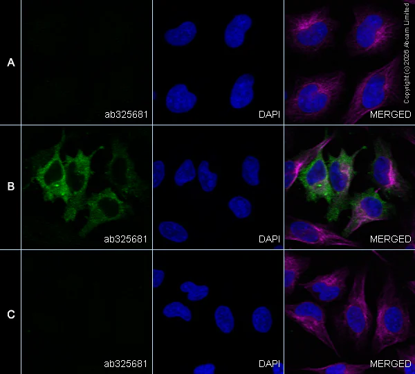 Immunocytochemistry/ Immunofluorescence - Anti-alpha Tubulin antibody [DM1A] - Loading Control (AB7291)