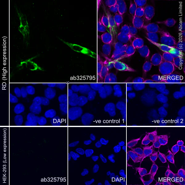 Immunocytochemistry/ Immunofluorescence - Anti-alpha Tubulin antibody [DM1A] - Loading Control (AB7291)