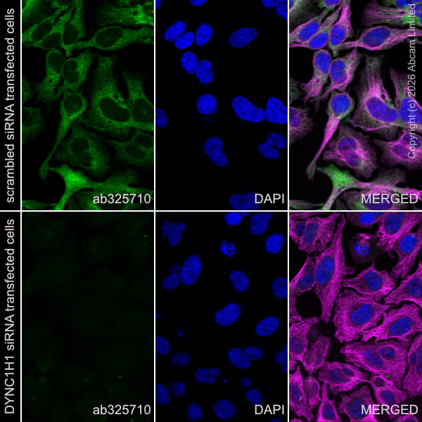 Immunocytochemistry/ Immunofluorescence - Anti-alpha Tubulin antibody [DM1A] - Loading Control (AB7291)