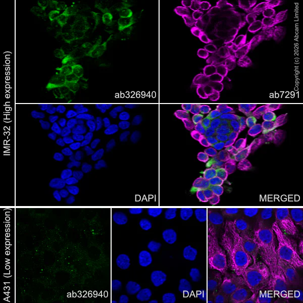 Immunocytochemistry/ Immunofluorescence - Anti-alpha Tubulin antibody [DM1A] - Loading Control (AB7291)