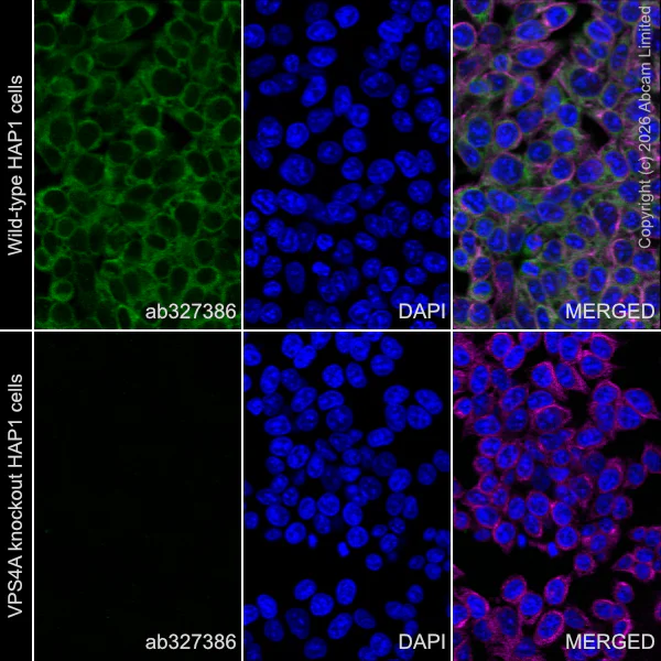 Immunocytochemistry/ Immunofluorescence - Anti-alpha Tubulin antibody [DM1A] - Loading Control (AB7291)