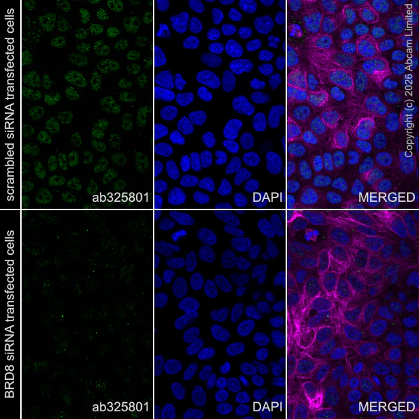 Immunocytochemistry/ Immunofluorescence - Anti-alpha Tubulin antibody [DM1A] - Loading Control (AB7291)