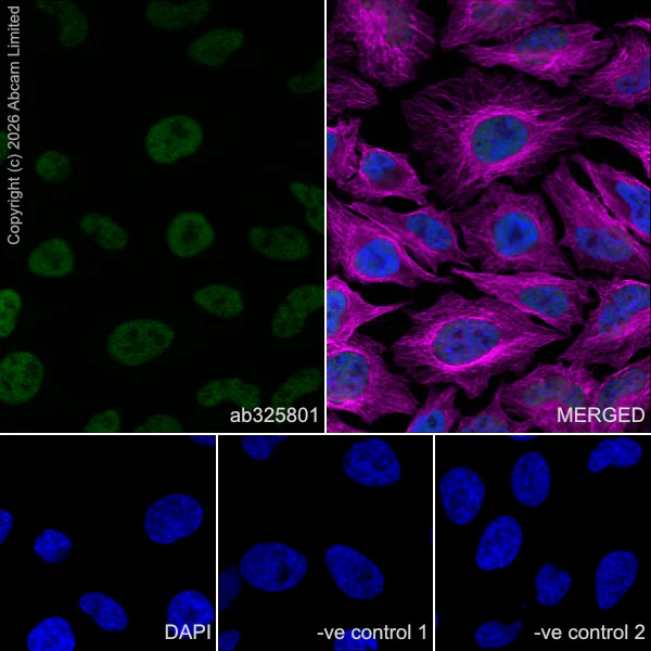 Immunocytochemistry/ Immunofluorescence - Anti-alpha Tubulin antibody [DM1A] - Loading Control (AB7291)