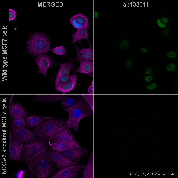 Immunocytochemistry/ Immunofluorescence - Anti-alpha Tubulin antibody [DM1A] - Loading Control (AB7291)