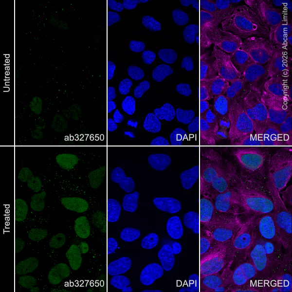 Immunocytochemistry/ Immunofluorescence - Anti-alpha Tubulin antibody [DM1A] - Loading Control (AB7291)