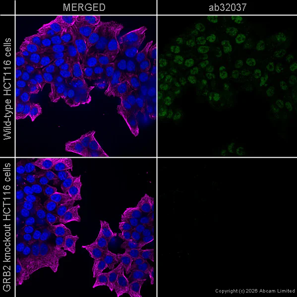 Immunocytochemistry/ Immunofluorescence - Anti-alpha Tubulin antibody [DM1A] - Loading Control (AB7291)