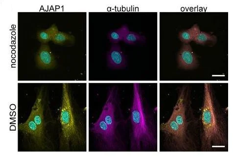 Immunocytochemistry/ Immunofluorescence - Anti-alpha Tubulin antibody [EP1332Y] - BSA and Azide free (AB216650)