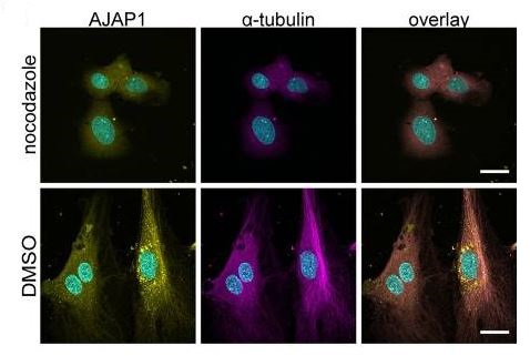 Immunocytochemistry/ Immunofluorescence - Anti-alpha Tubulin antibody [EP1332Y] - Loading Control (AB52866), expandable thumbnail