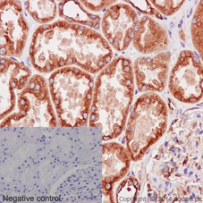 Immunohistochemistry (Formalin/PFA-fixed paraffin-embedded sections) - Anti-alpha Tubulin antibody [EPR13478(B)] - Loading Control (AB176560), expandable thumbnail