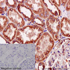 Immunohistochemistry (Formalin/PFA-fixed paraffin-embedded sections) - Anti-alpha Tubulin antibody [EPR13478(B)] - Loading Control (AB176560)