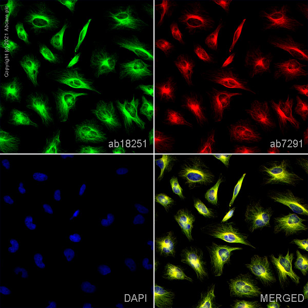 Immunocytochemistry/ Immunofluorescence - Anti-alpha Tubulin antibody - Loading Control (ab18251), expandable thumbnail