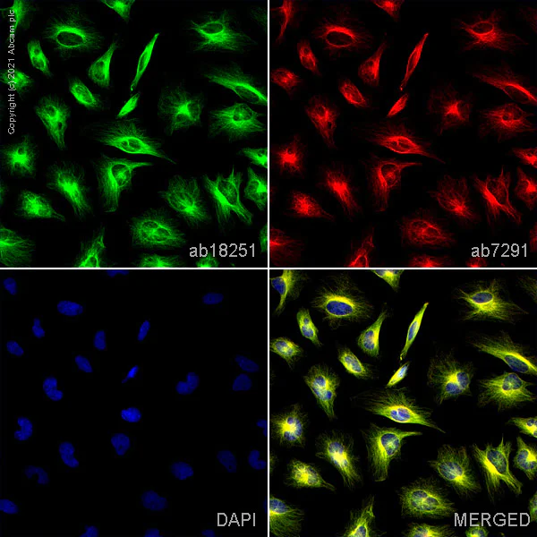 Immunocytochemistry/ Immunofluorescence - Anti-alpha Tubulin antibody - Loading Control (AB18251)