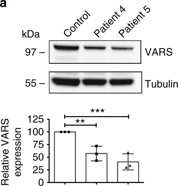 Western blot - Anti-alpha Tubulin antibody - Loading Control (AB4074)