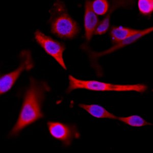 Immunocytochemistry/ Immunofluorescence - Anti-alpha Tubulin antibody [RM113] - C-terminal (AB190471), expandable thumbnail