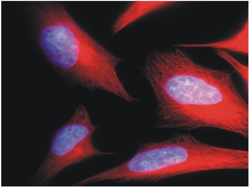 Immunocytochemistry/ Immunofluorescence - Anti-alpha Tubulin antibody [TU-01] (AB7750), expandable thumbnail
