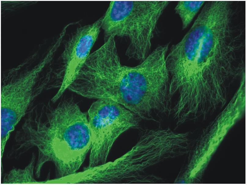 Immunocytochemistry/ Immunofluorescence - Anti-alpha Tubulin antibody [TU-01] (ab7750), expandable thumbnail