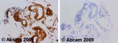 Immunohistochemistry (Formalin/PFA-fixed paraffin-embedded sections) - Anti-alpha Tubulin antibody [TU-01] (AB7750), expandable thumbnail