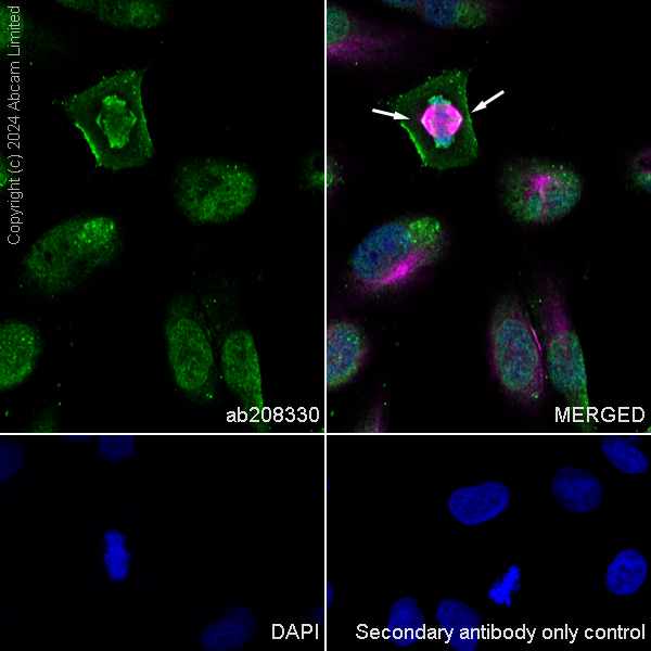 Immunocytochemistry/ Immunofluorescence - Anti-alpha Tubulin (tri methyl K40) antibody [18-6] (AB208330), expandable thumbnail