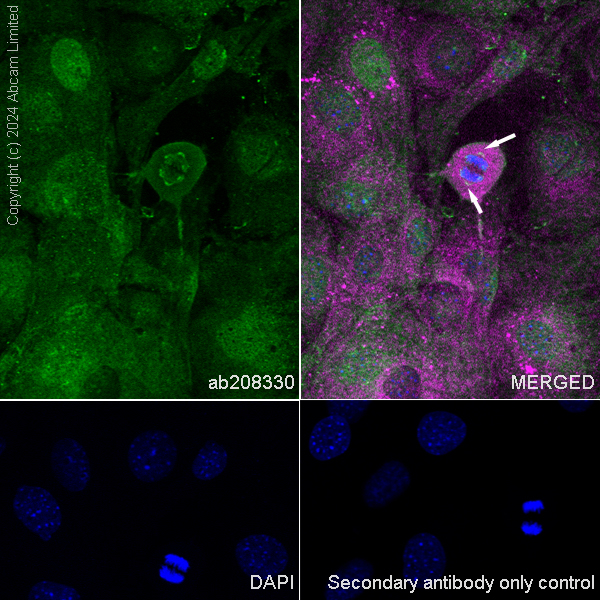 Immunocytochemistry/ Immunofluorescence - Anti-alpha Tubulin (tri methyl K40) antibody [18-6] (AB208330), expandable thumbnail